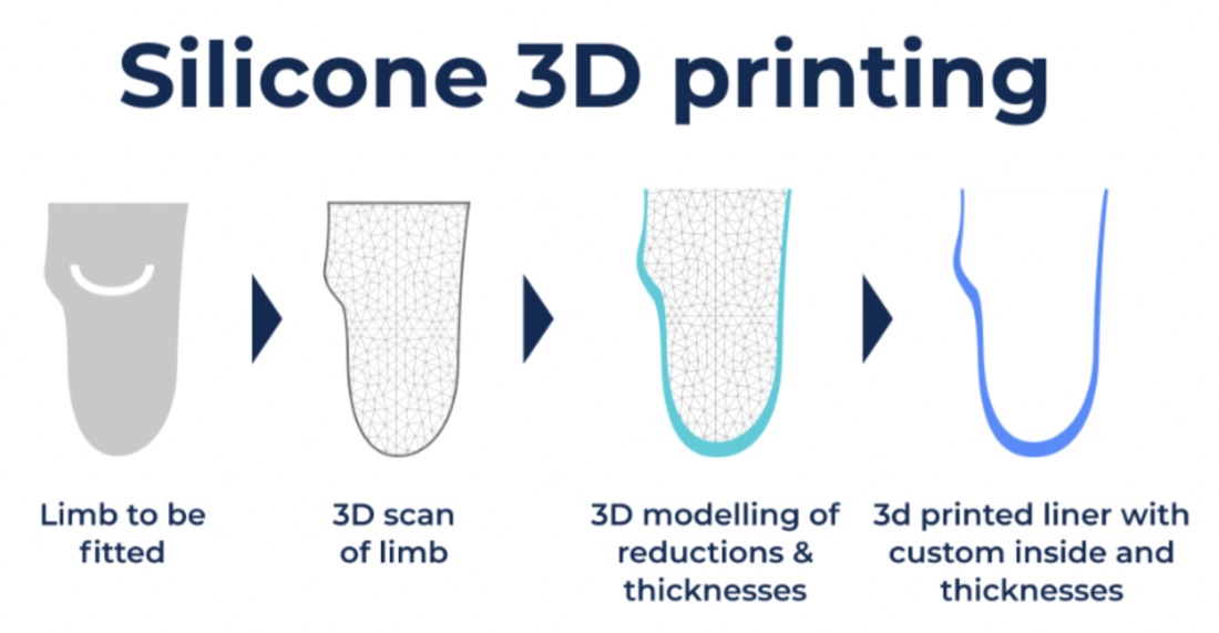 Our solution: 3D-printed silicone liners