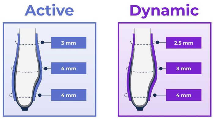 Pre-defined Active and Dynamic sleeve thickness profiles