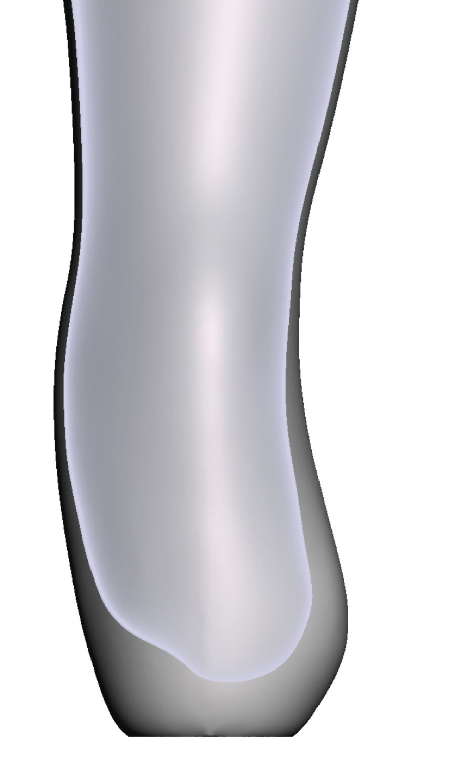 Esostosi — Modello 3D