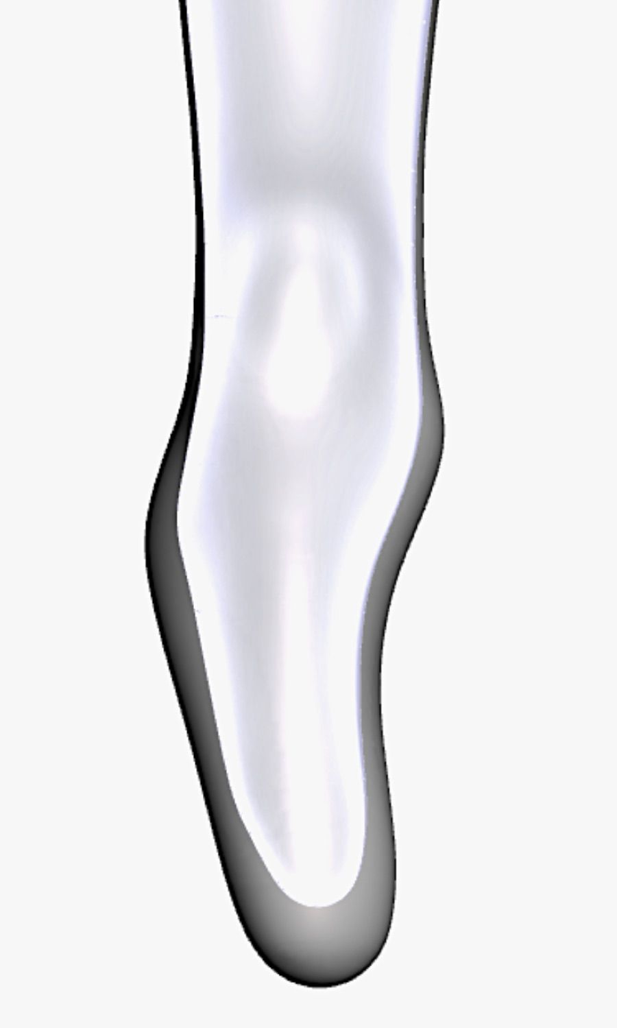 Condilo prominente — Modello 3D