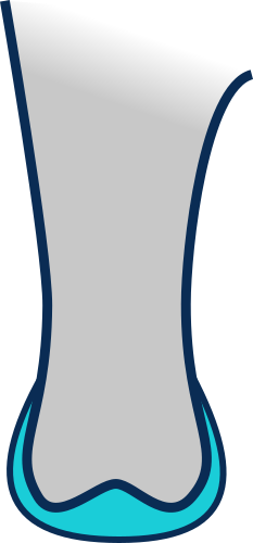 Adapted distal shape
