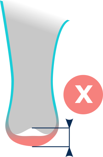 Thick distal cushion limits knee space