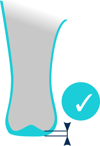Localised extra cushioning