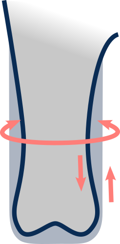 Pear-shape compensation