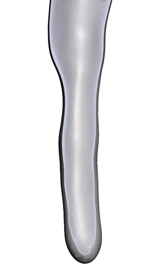 Congenital — 3D model