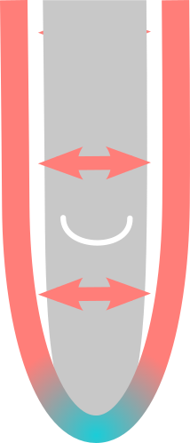 No suitably sized standard liner