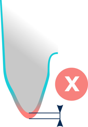 Insufficient cushioning on femoral extremity