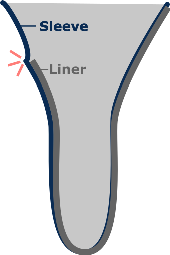 Sleeve is longer than the liner and pinches the skin