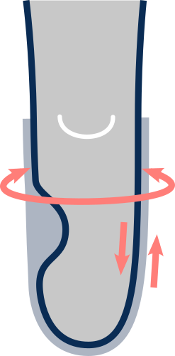 Socket adaptations needed (soft socket, modular openings)