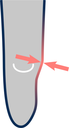 Standard liner offers inadequate cushioning