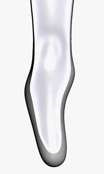 Prominent Condyle — 3D model