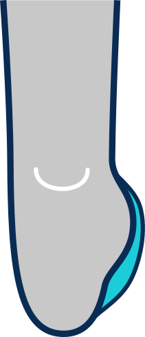 Adapted compressions and thickness
