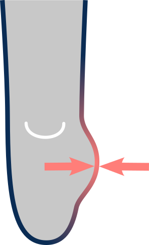 Standard liner offers inadequate cushioning