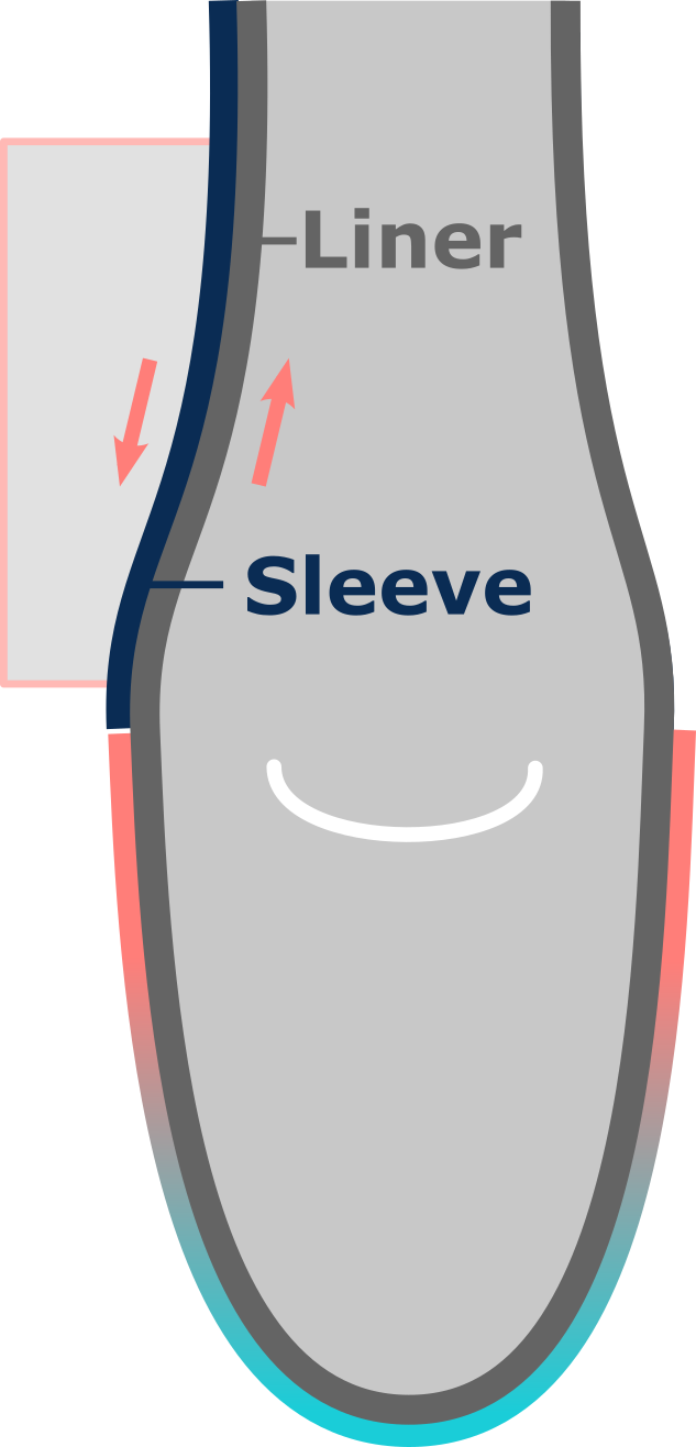 Sleeve related issues