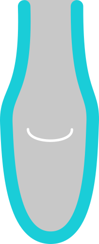 Adapted shape and compression