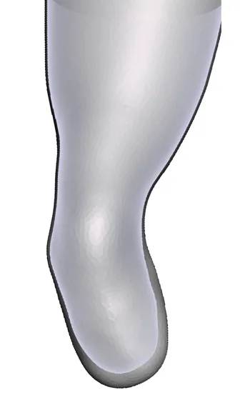 Varus/Valgus — 3D model